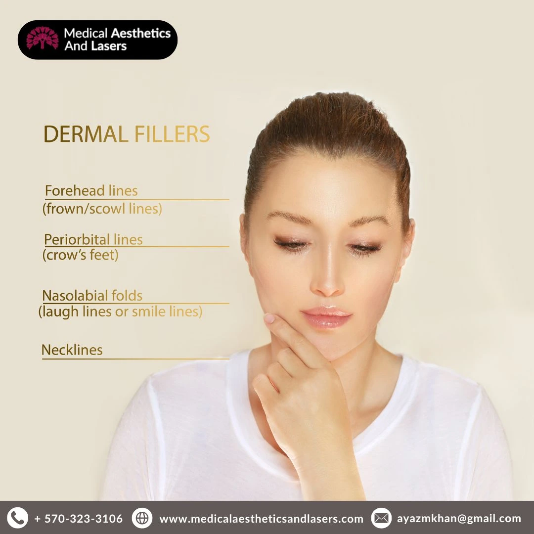 Dermal Fillers Treatment in Williamsport, PA - Smooth, Youthful Skin