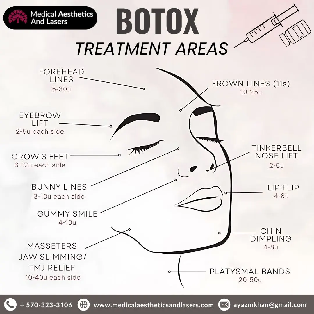 Injectable Botox Treatment in Lewisburg, PA - Medical Aesthics