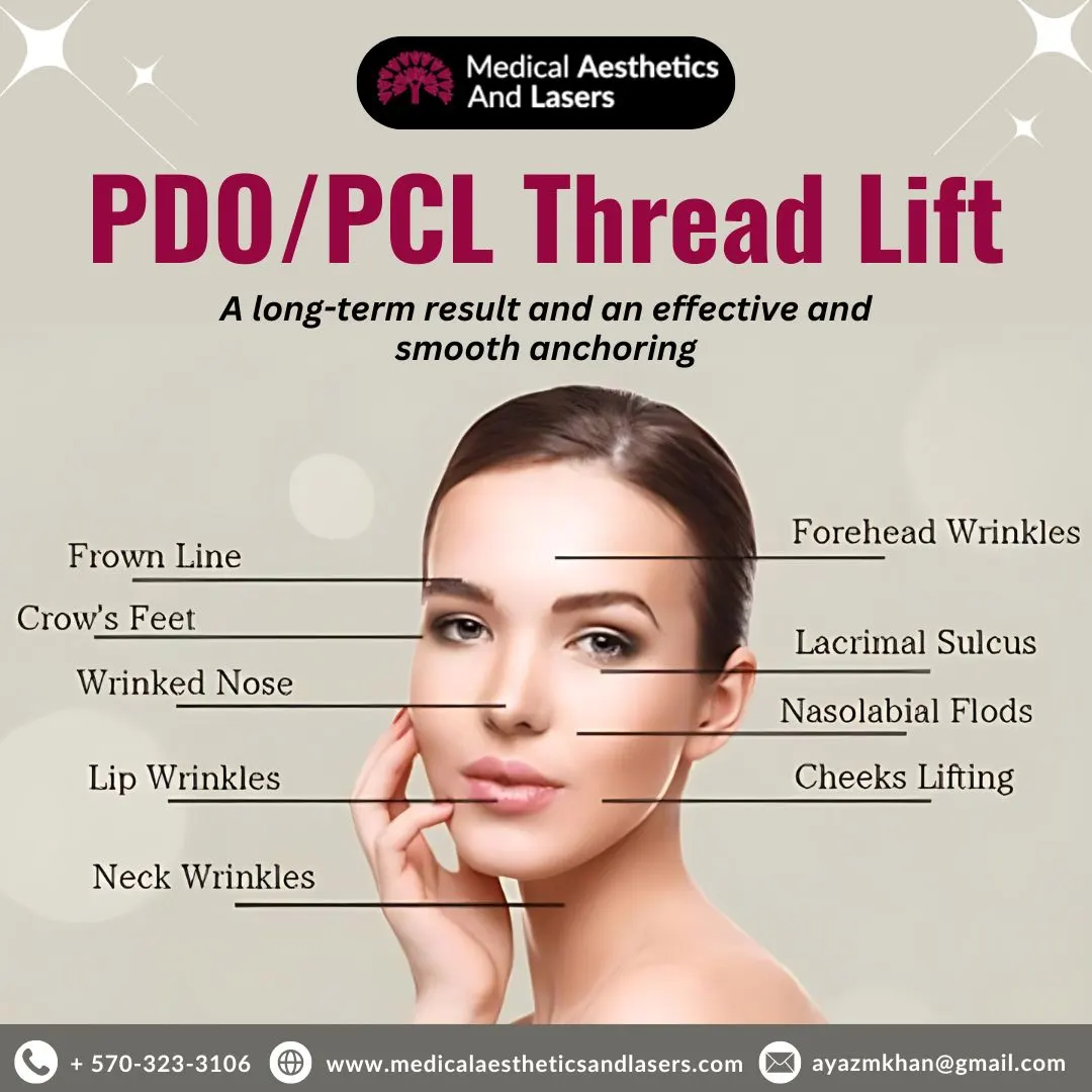 PDO/PCL Thread Lift - Non-Surgical Skin Lift | Medical Aesthetics